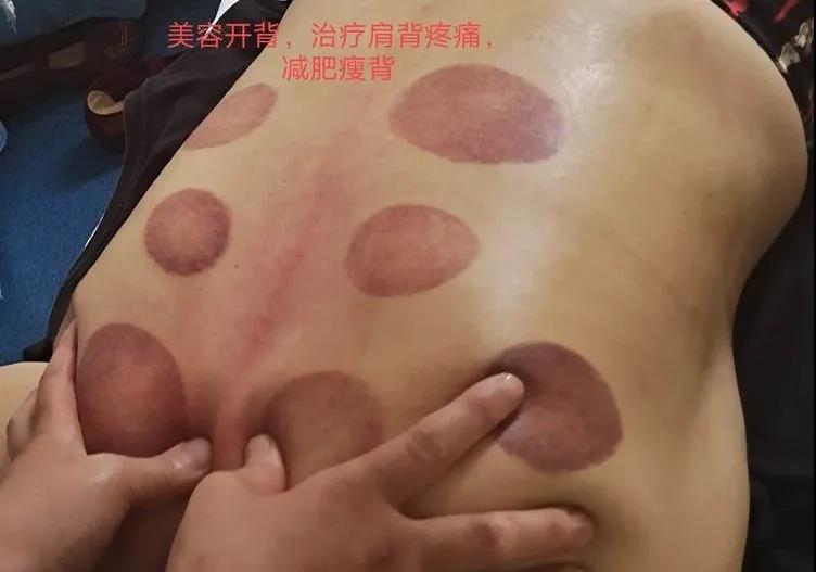 点击查看原图