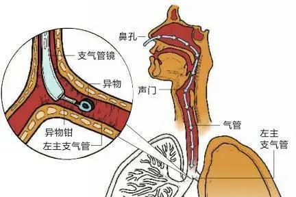 点击查看原图