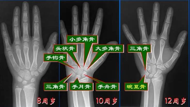 点击查看原图