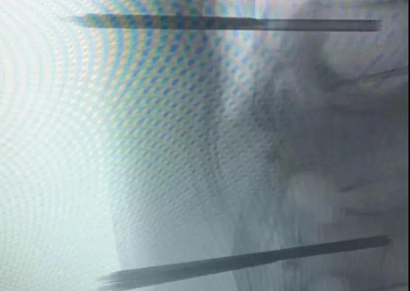 点击查看原图