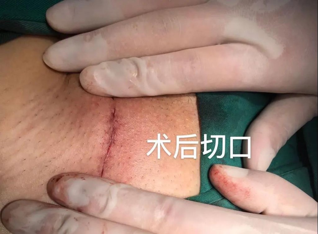 点击查看原图