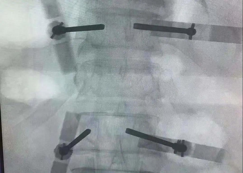 点击查看原图