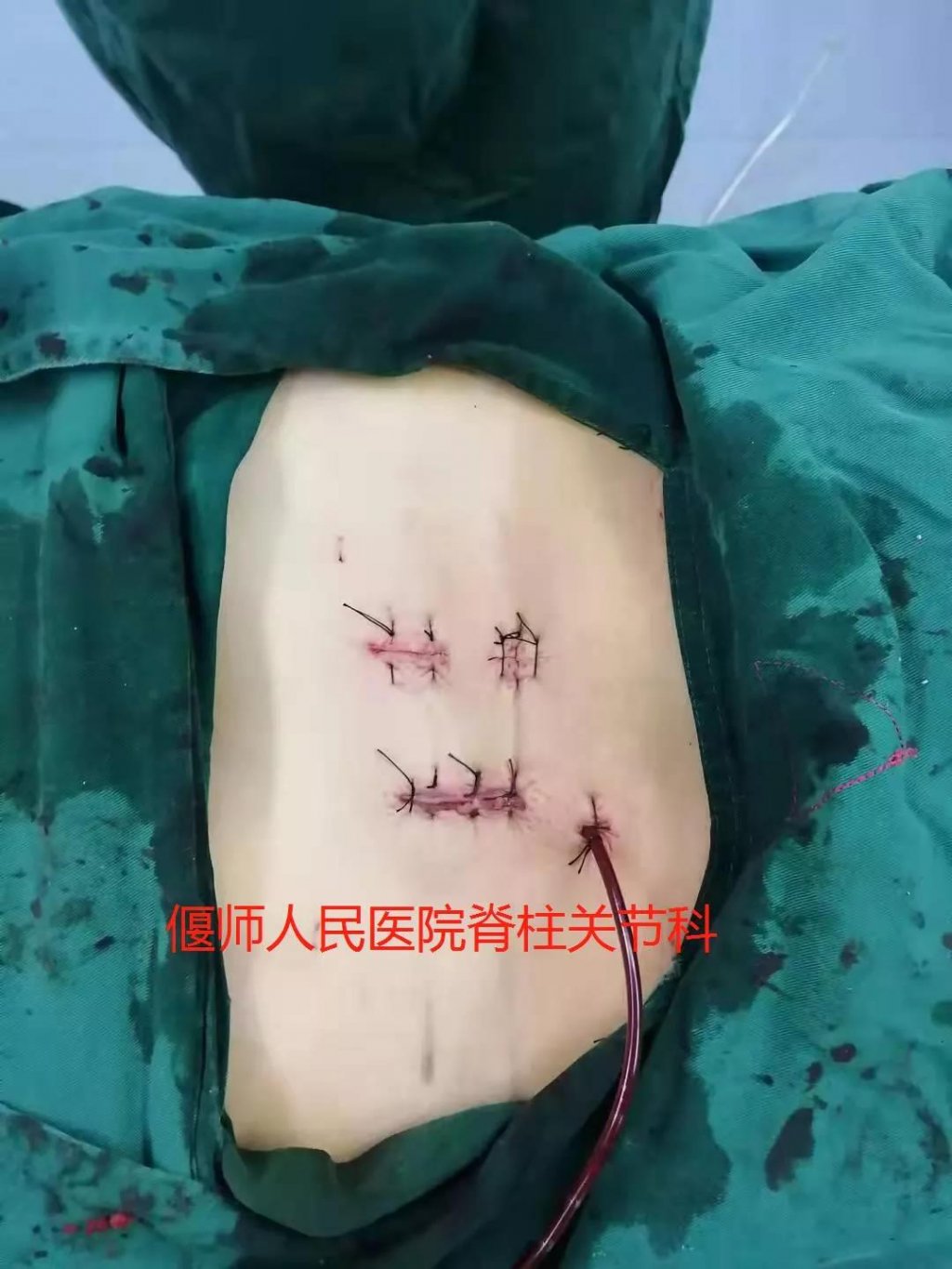 点击查看原图