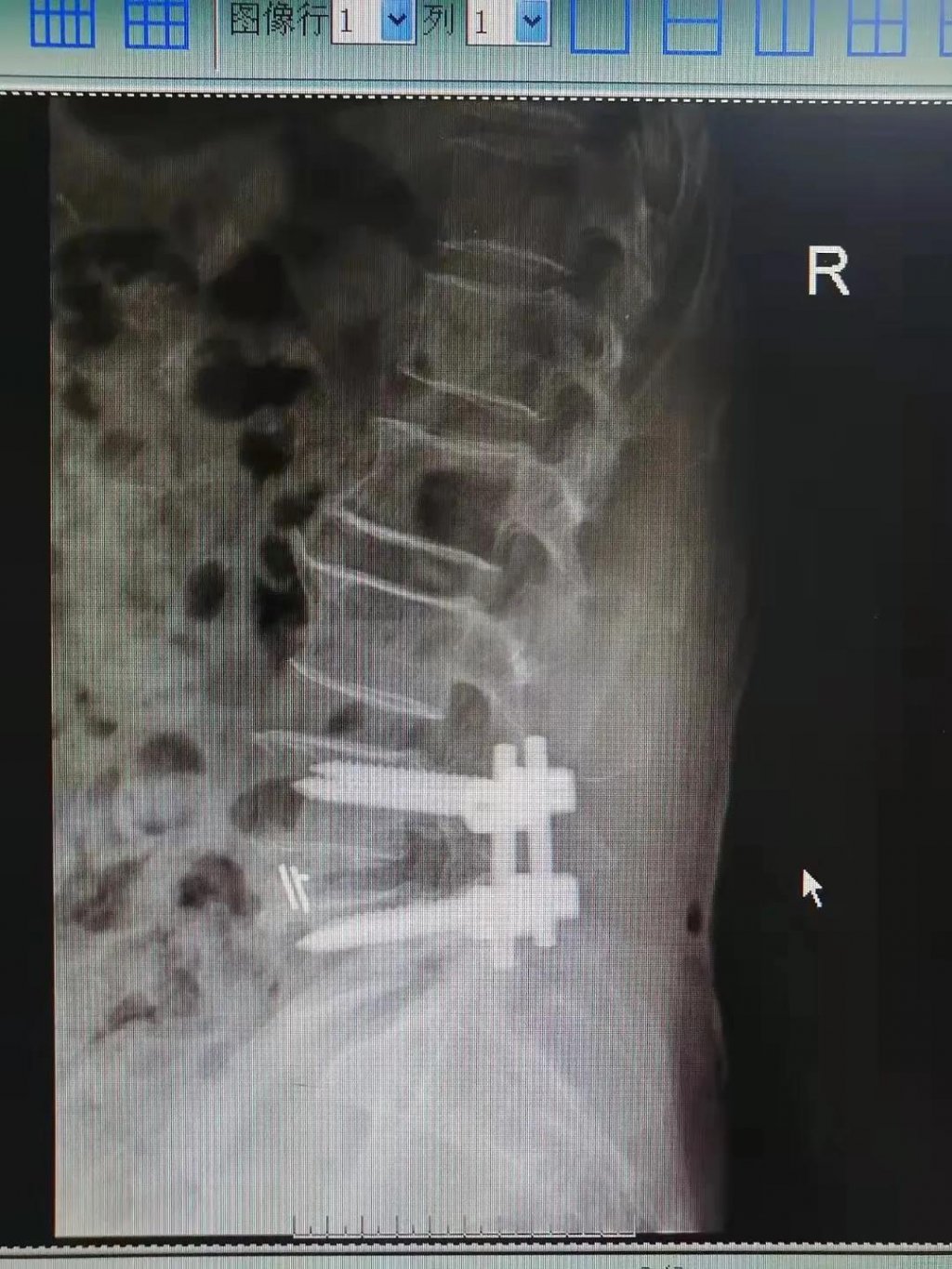 点击查看原图